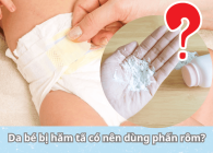 Da bé bị hăm tã có nên dùng phấn rôm? Giải đáp từ chuyên gia da liễu nhi