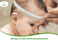 Dấu Hiệu Trẻ Thiếu Chất Mẹ Không Nên Bỏ Qua