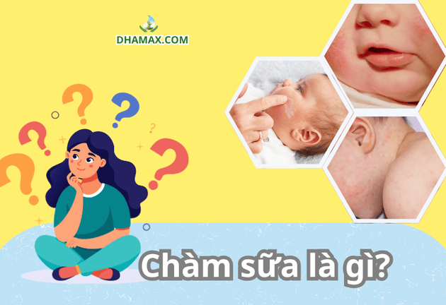 Các mẹo chăm sóc khi con bị chàm sữa