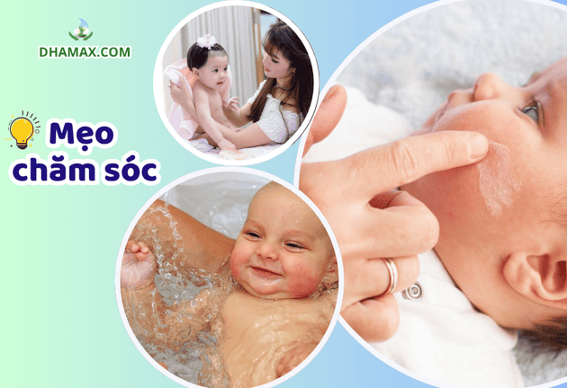 Các mẹo chăm sóc khi con bị chàm sữa