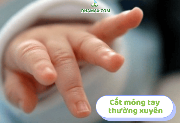 Các mẹo chăm sóc khi con bị chàm sữa