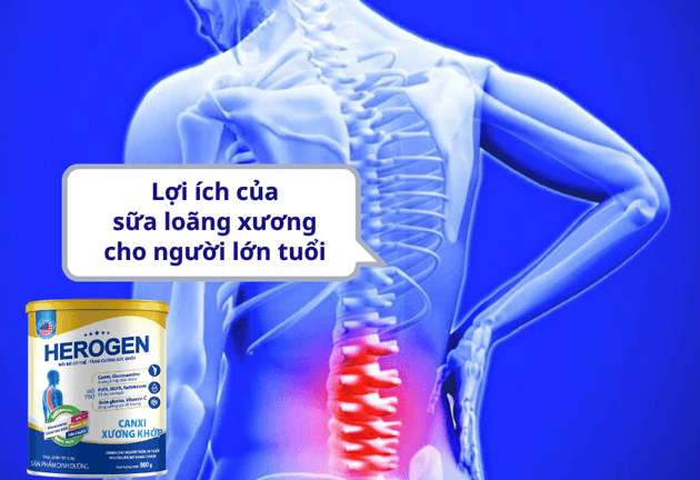Sữa nào hỗ trợ xương khớp và ngăn ngừa loãng xương