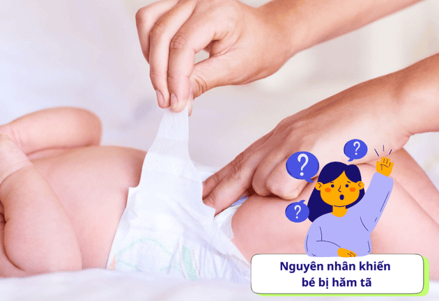 Top 3 Sản Phẩm Nên Có Khi Chăm Bé Bị Hăm Tã