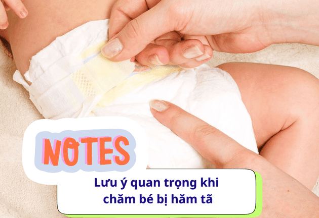 Top 3 Sản Phẩm Nên Có Khi Chăm Bé Bị Hăm Tã