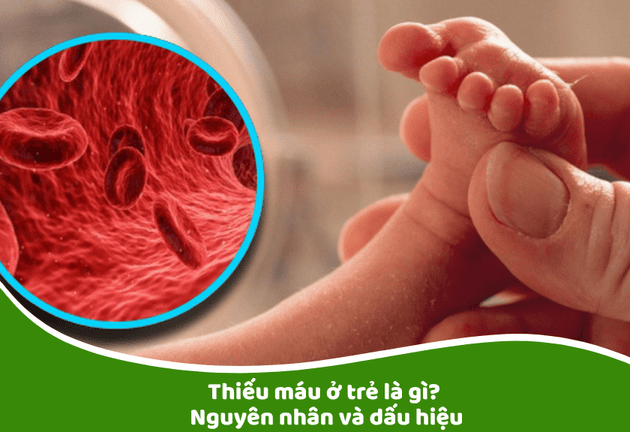 sữa bổ sung sắt cho trẻ