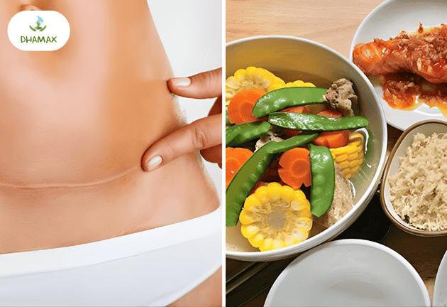 Điều mẹ bỉm cần biết trước và sau khi sinh